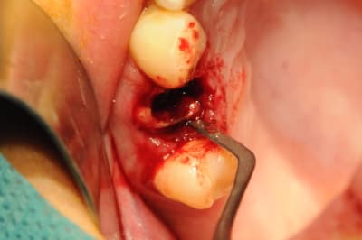 Dsc 2556 xophhg - Eugenol