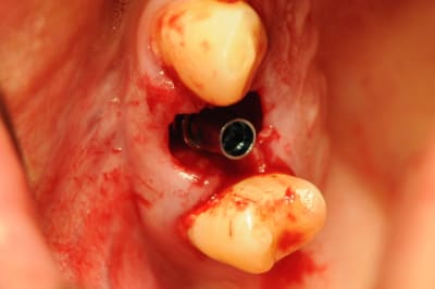 Dsc 2562 utie1q - Eugenol