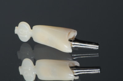 Dsc 2575 oxpzoe - Eugenol