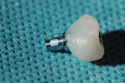 Dsc 2594 qyadwe - Eugenol