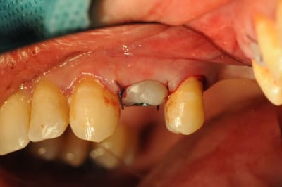 Dsc 2605 jiui6c - Eugenol