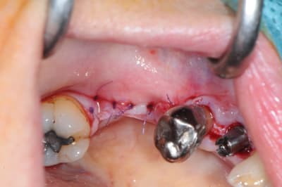 Dsc 2795 nsfqfx - Eugenol