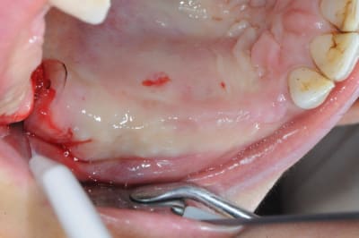 Dsc 2882 fiix5l - Eugenol