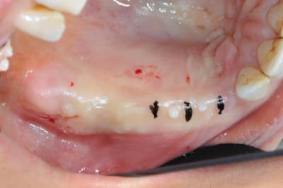 Dsc 2884 rz25vx - Eugenol