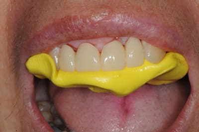 Dsc 2982 lasynx - Eugenol