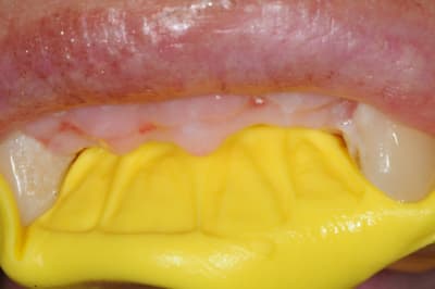 Dsc 2984 we68sc - Eugenol