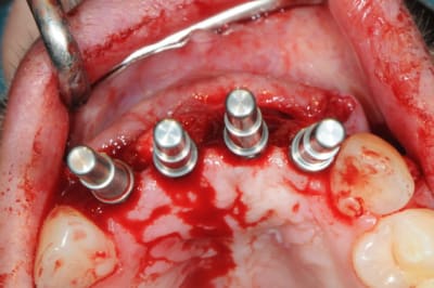 Dsc 2994 odmplk - Eugenol