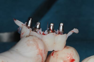 Dsc 3020 w1zm0x - Eugenol