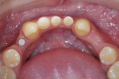 Dsc 3098invers  zyozx0 - Eugenol