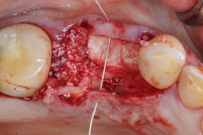 Dsc 3139 xw0zwr - Eugenol