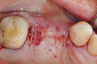 Dsc 3140 lrbgnx - Eugenol