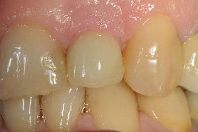 Dsc 3246 u6jder - Eugenol