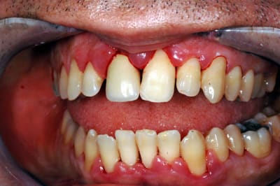 Dsc 3485 k4vkqv - Eugenol