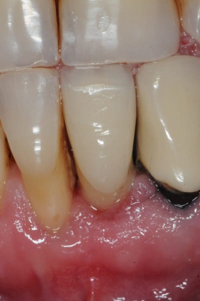 Dsc 3543 kwu2ti - Eugenol