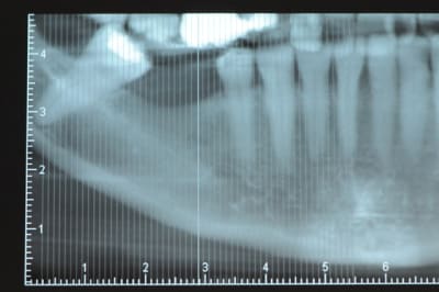 Dsc 3594 emsmta - Eugenol
