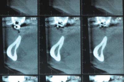 Dsc 3596 hszdxo - Eugenol