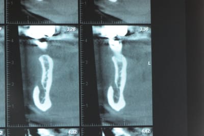 Dsc 3600 pubnni - Eugenol