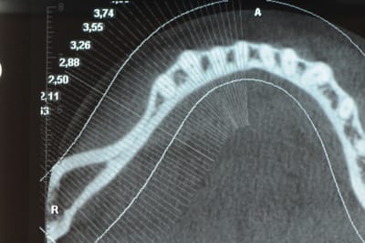 Dsc 3602 az09kp - Eugenol