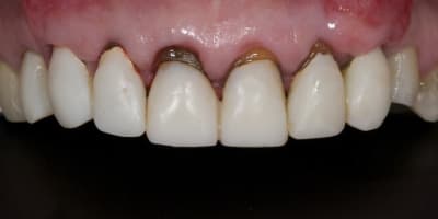 Dsc 3653 e5cffv - Eugenol