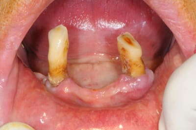 Dsc 3671 gvlcms - Eugenol