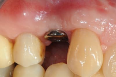 Dsc 3730 m2gptb - Eugenol