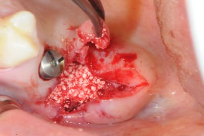 Dsc 3884 q22hbj - Eugenol