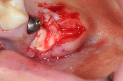 Dsc 3888 nyltkp - Eugenol