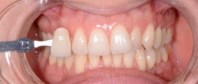 Dsc 3996 unxmvo - Eugenol