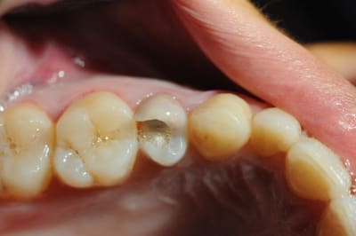 Dsc 4083 gdrju2 - Eugenol