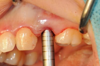 Dsc 4088 qziaiy - Eugenol