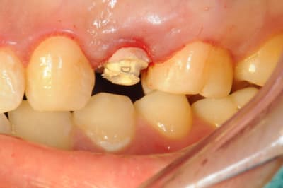 Dsc 4126 l6ecqu - Eugenol