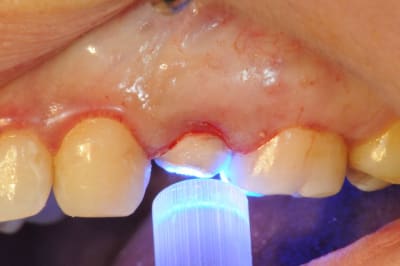 Dsc 4127 f2jjf6 - Eugenol