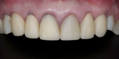 Dsc 4143 heqrcf - Eugenol