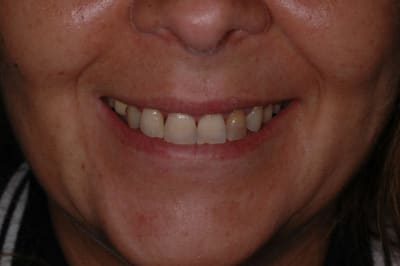 Dsc 4204 x5tr5d - Eugenol