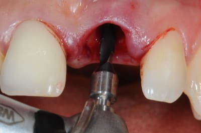 Dsc 4265 qwmndn - Eugenol