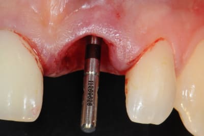 Dsc 4266 zud94m - Eugenol