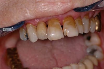 Dsc 4351 dvjqvd - Eugenol