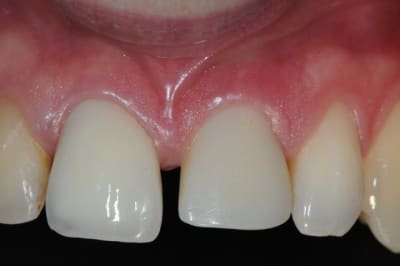 Dsc 4363 krzdrr - Eugenol