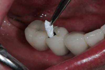 Dsc 4382 wmqlph - Eugenol