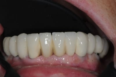 Dsc 4388 q7fmnq - Eugenol