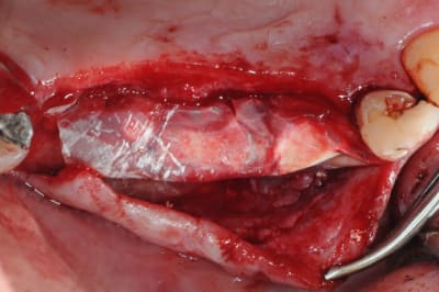 Dsc 4619 rzzjrp - Eugenol