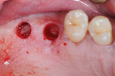 Dsc 4777 ftizv3 - Eugenol