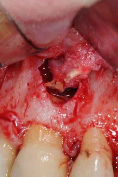 Dsc 4992 abdbuf - Eugenol