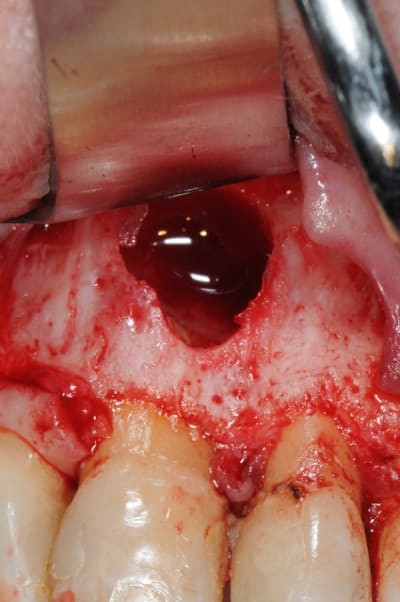 Dsc 5002 h4287n - Eugenol