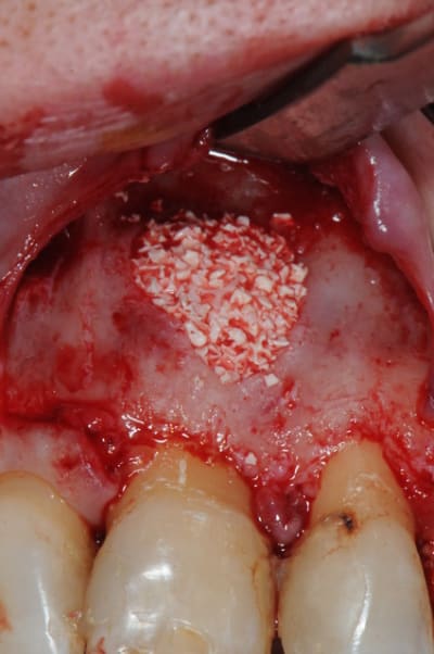 Dsc 5006 sltegi - Eugenol