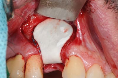 Dsc 5072 n0f4ct - Eugenol