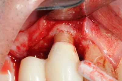 Dsc 5087 tlbwlc - Eugenol