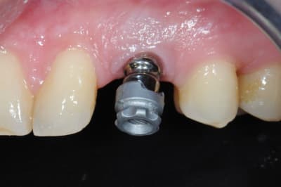 Dsc 5358 j318gd - Eugenol