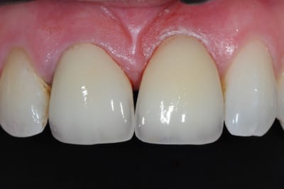 Dsc 5490 wzrnos - Eugenol