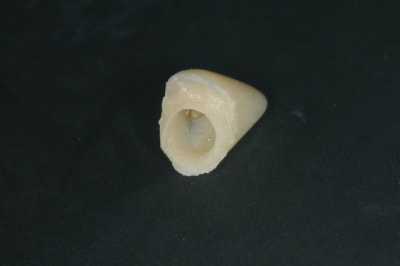 Dsc 5688 ff5tdp - Eugenol